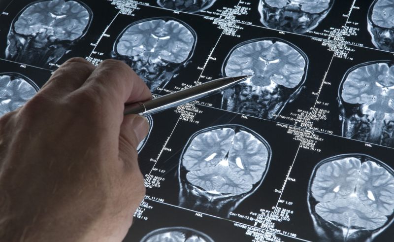 Leqembi Becomes First Targeted Alzheimer’s Drug Approved in KSA